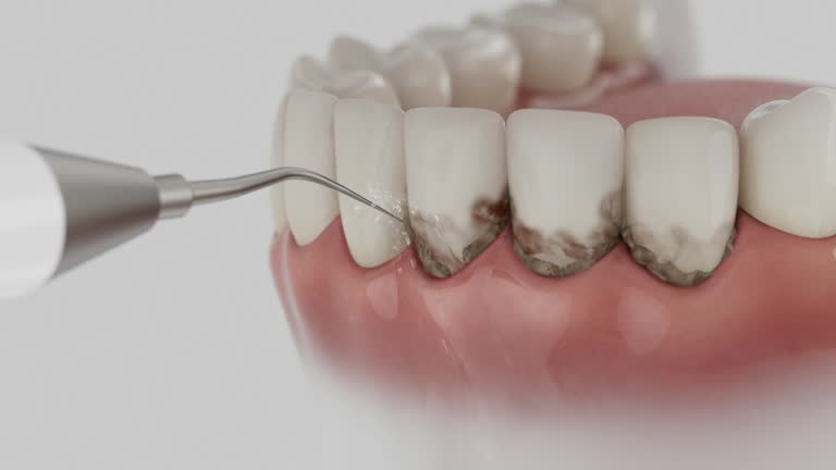 Reliable Dental Implants contractor in Wayne County County, WV by Dentist Open Now